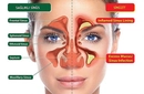 Sinüzit ve Öksürük Belirtileri ve Tedavisi